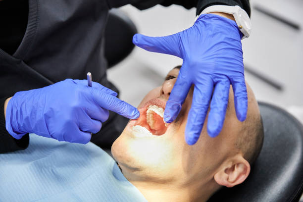 Best Urgent Care for Lost Fillings or Crowns in Port Barrington, IL